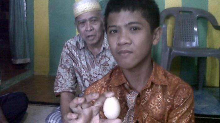 Sempat Heboh Dua Tahun Lalu, Remaja 14 Tahun Ini Bertelur Lagi
